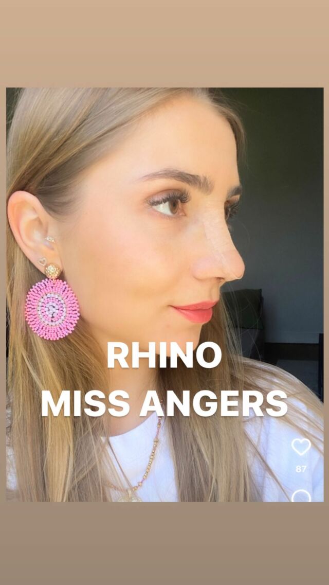 Suivons l’évolution rhinoplastie  de notre jolie miss d’Angers sur les premiers semaines ✨

Rhino préservation ulltrasonique
Rdv dans 3 et 6 mois pour le résultat définitif 🔜

#rhinoplastie #rhinoplasty #preservationrhinoplasty #ultrasons #piezotome